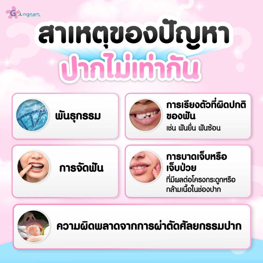 สาเหตุของปัญหาปากไม่เท่ากัน