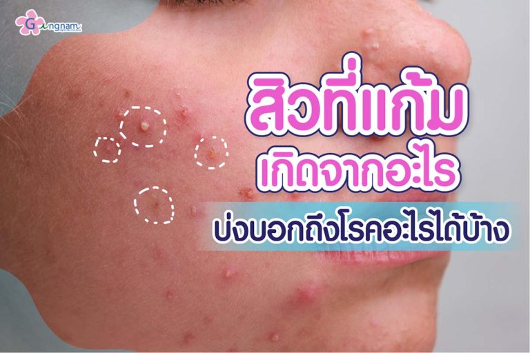 7 วิธีทําให้หน้าใส ไร้สิว วิธีไหนช่วยให้ผิวกระจ่างใสแบบธรรมชาติ และได้ผลจริง