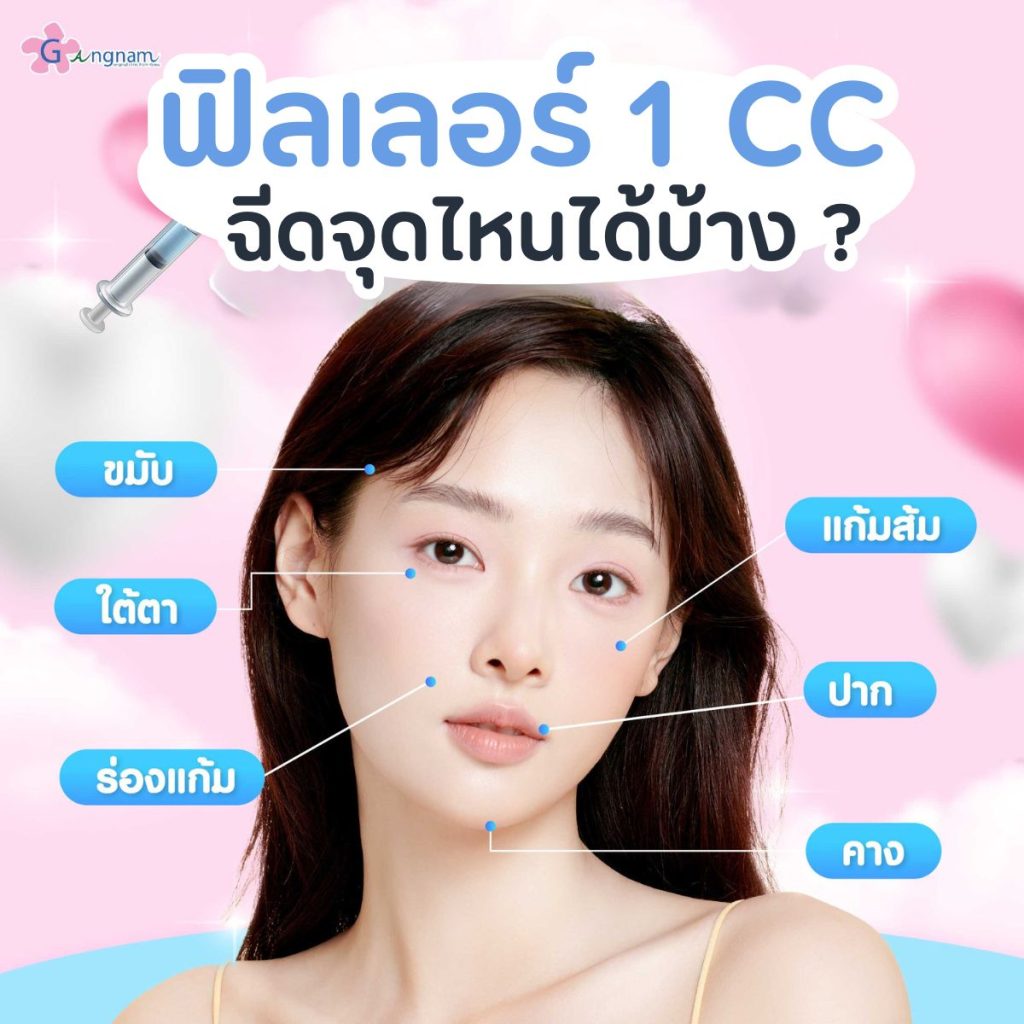 ฟิลเลอร์ 1 CC ฉีดจุดไหนได้บ้าง