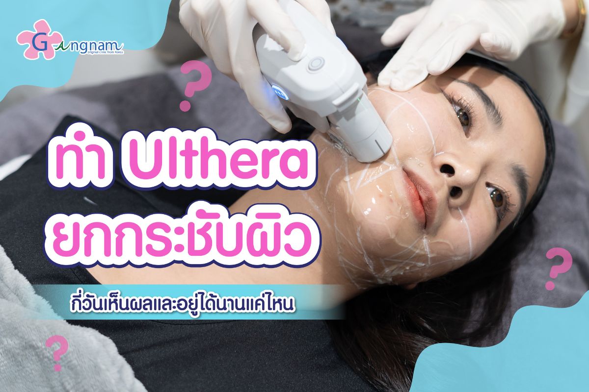 อัลเทอร่า ulthera กี่วันเห็นผล