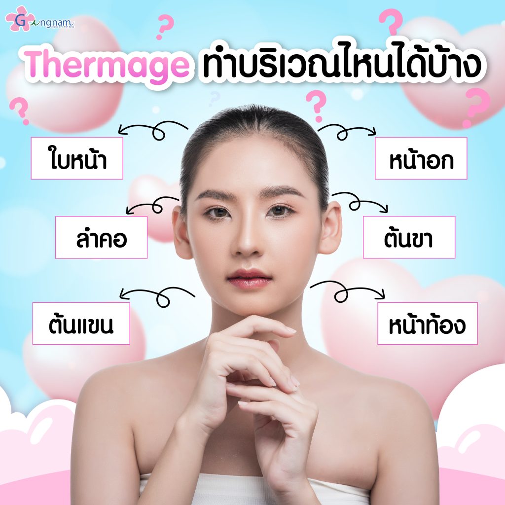 Thermageทำบริเวณไหนได้บ้าง