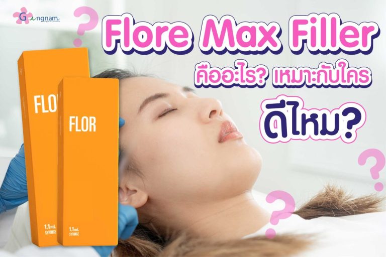 ฟิลเลอร์ flore max คืออะไร ควรฉีดดีไหม ต่างกับยี่ห้ออื่นอย่างไร