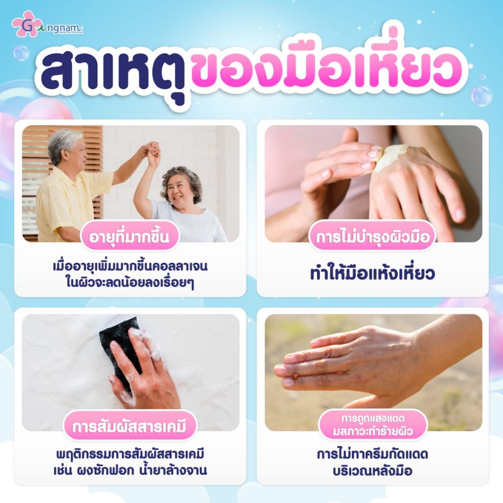 สาเหตุของมือเหี่ยว