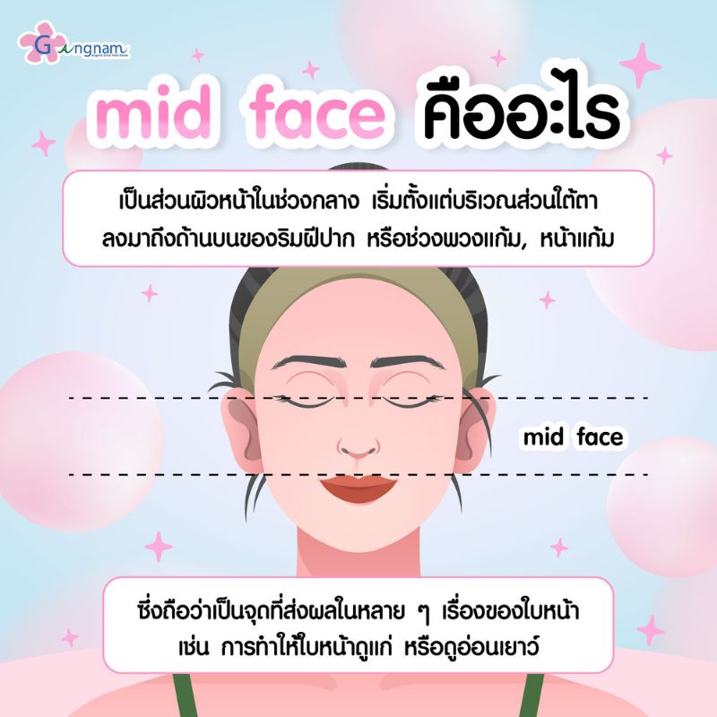 ความหมายของ mid face 