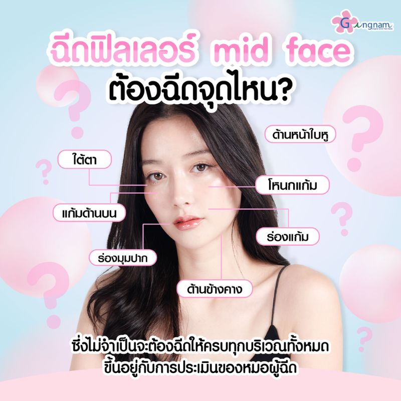 ฉีดฟิลเลอร์ mid face ต้องฉีดจุดไหน