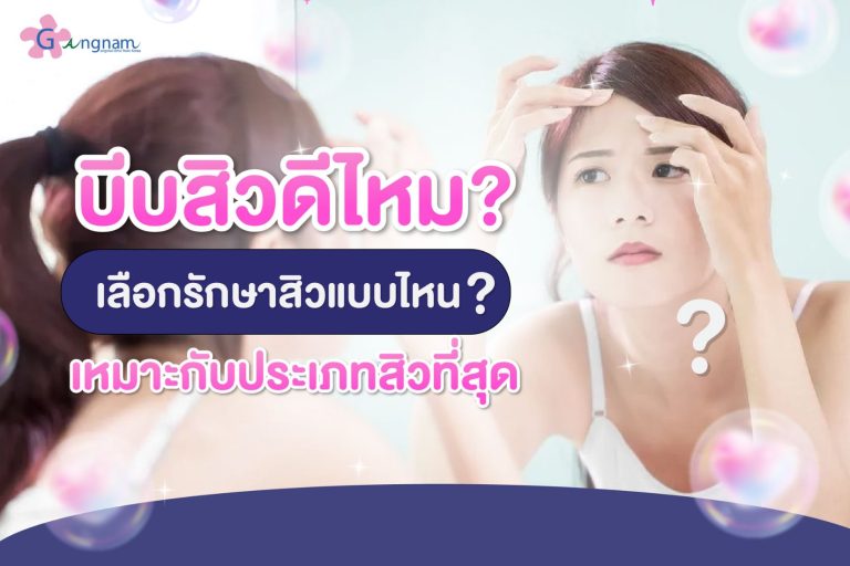 บีบสิวได้หรือไม่? รักษาสิวด้วยวิธีไหนถึงจะปลอดภัย ไม่ทำร้ายผิว