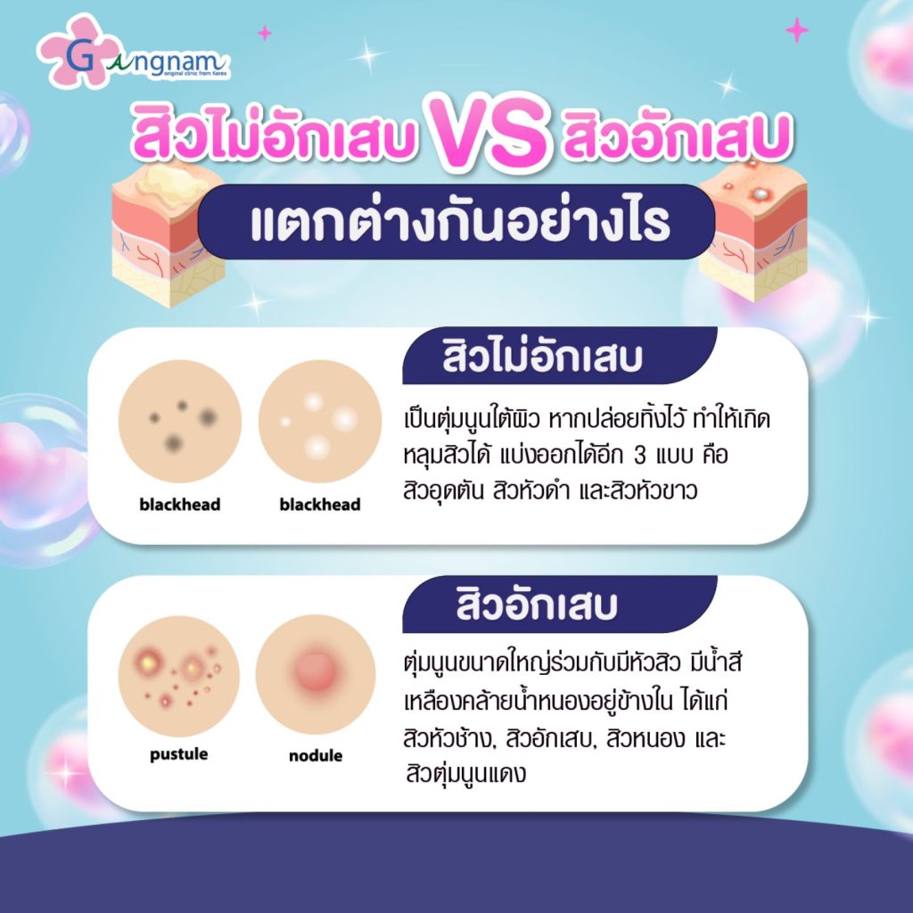 สิวไม่อักเสบvsสิวอักเสบต่างกันอย่างไร